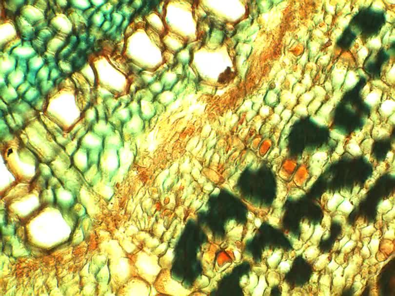 【生物显微录像】榕树三年 根质横切