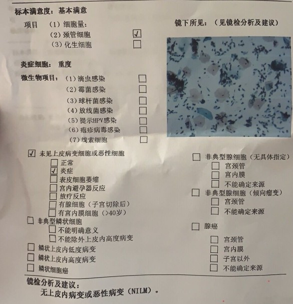 hpv53阳性 多久转阴