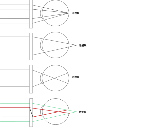 眼睛的外凸问题
