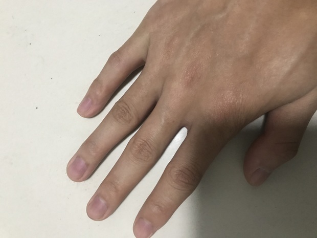 我的指甲发紫什么个情况?
