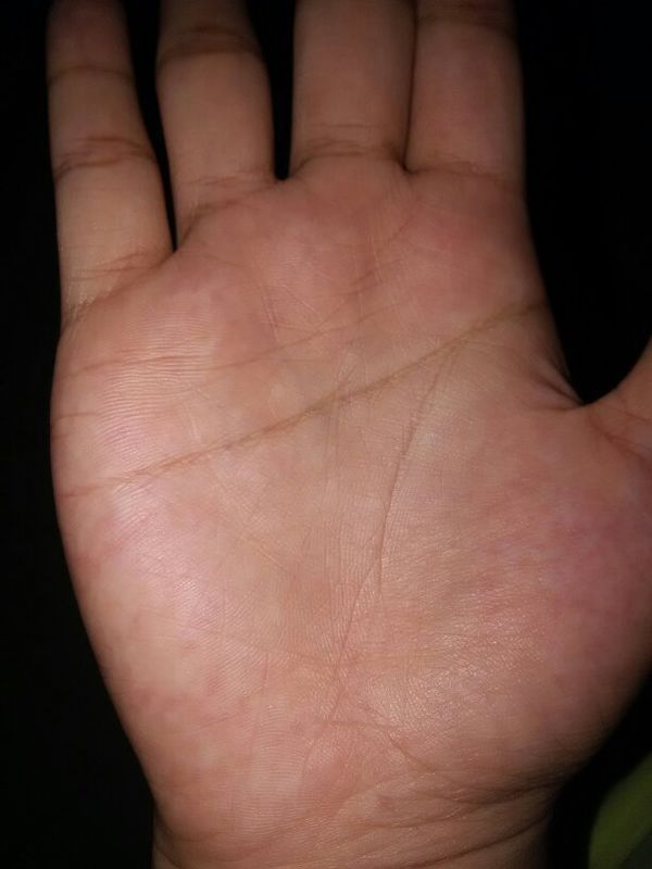 求仔细帮我看看我是真断掌还是假断掌(说出理由),大部分说是真的少