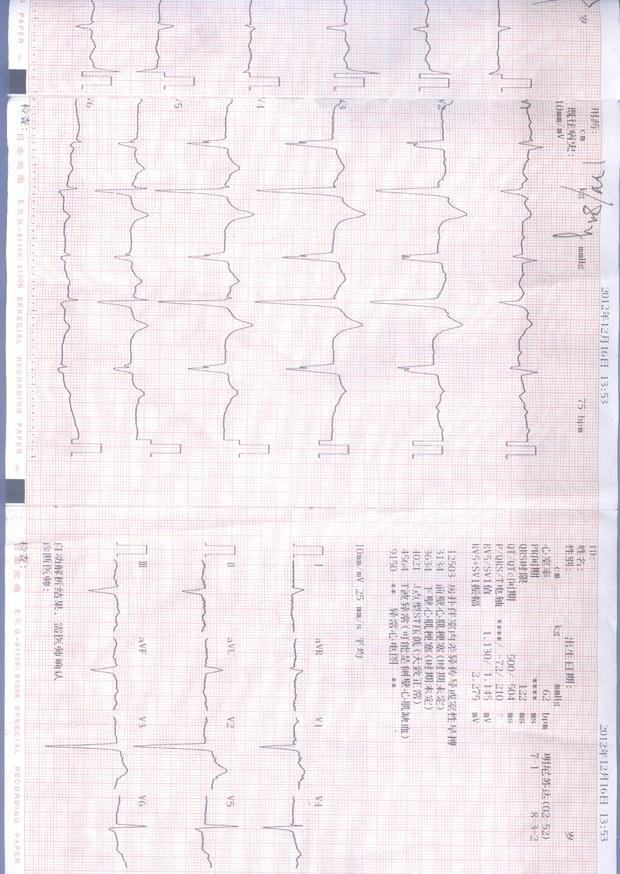 心电图及心脏彩超报告单