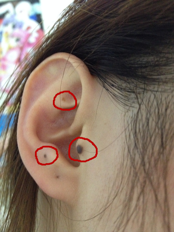 请大师看看我耳朵上的痣好还是不好啊?