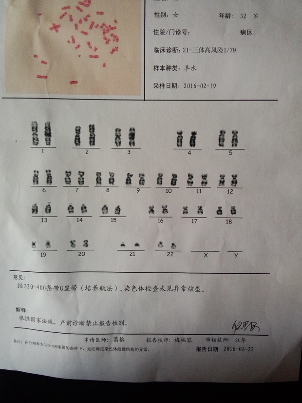 人染色体核型分析客观结果怎么看男女