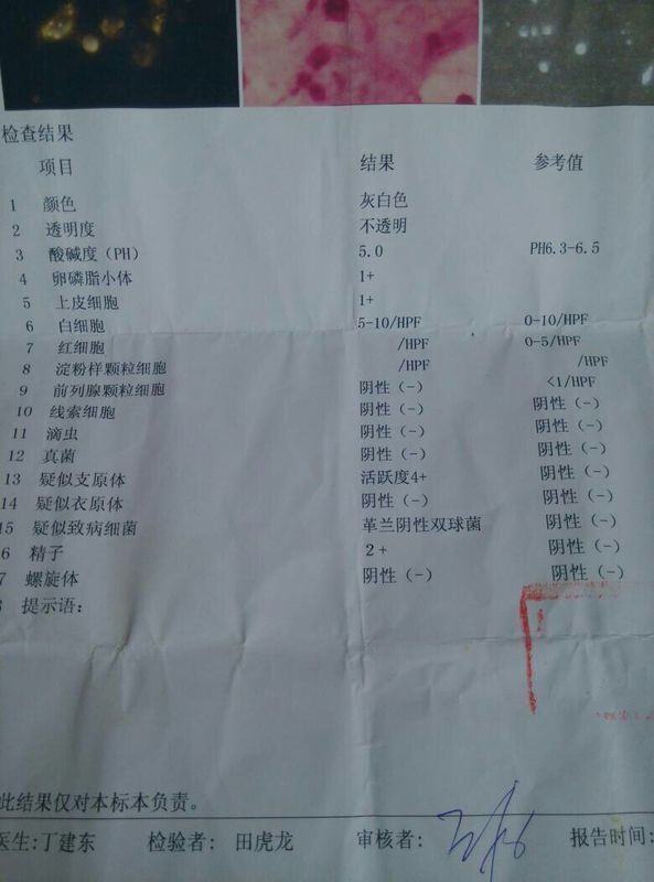 两月前正规医院做前列腺液常规b超都正常,昨天在市医院检查前列腺液小