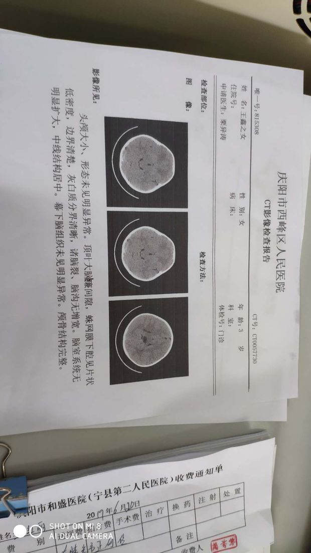 3岁女童,顶叶大脑镰,蛛网膜下间隙囊肿都考虑,建议mr