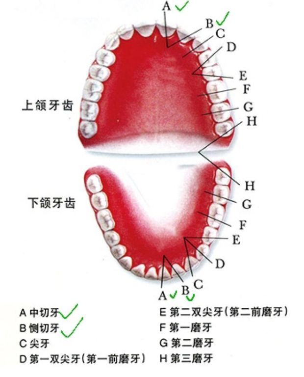 如何鉴别左右上颌中切牙