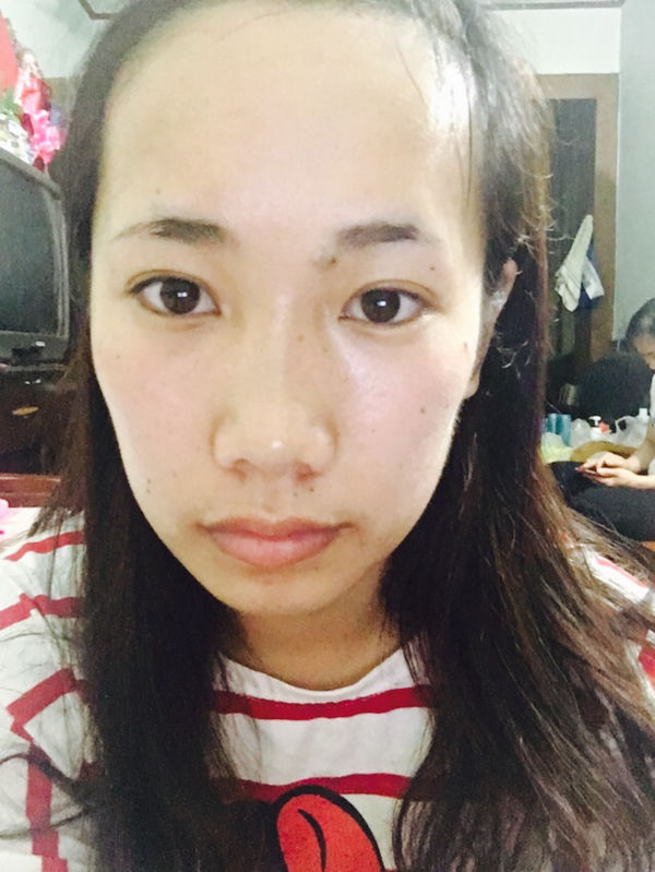 脸歪 怎么可以矫正呀 以这种 急