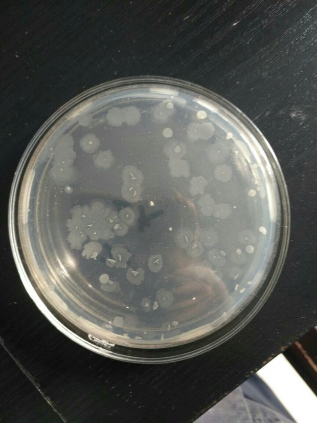 您好,关于微生物,我用的是平板计数琼脂,这个平皿长的