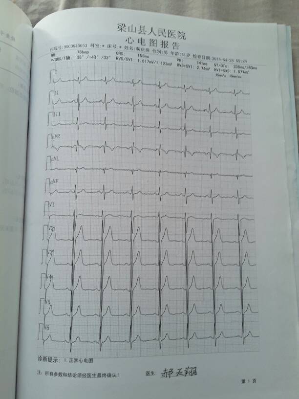 心电图怎么看啊?
