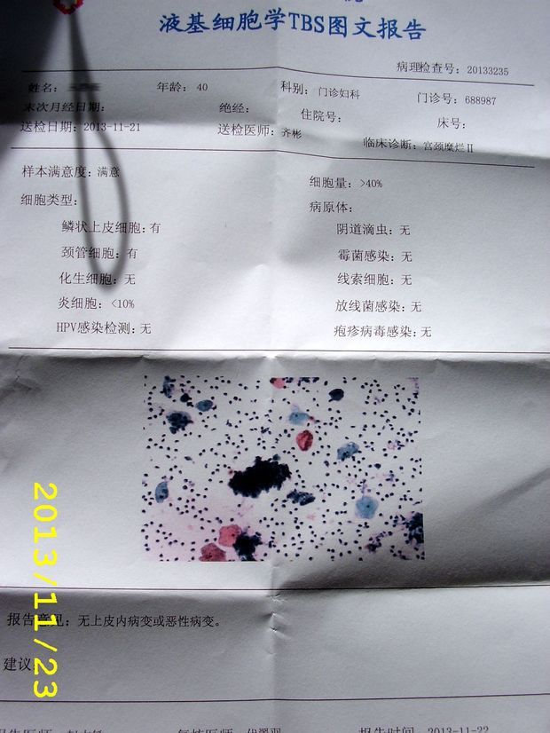 我做了tct,液基细胞学tbs图文报告单出来了,帮我看看!