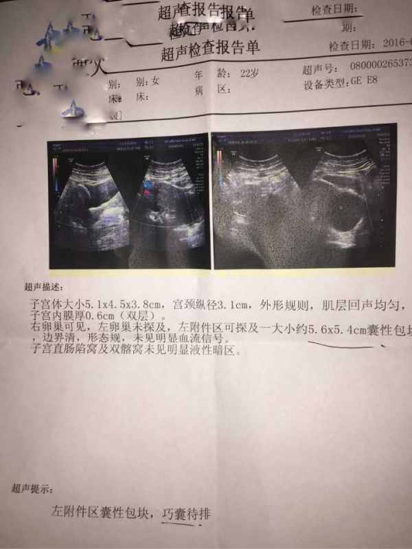 什么原因会引起女性出现子宫囊肿