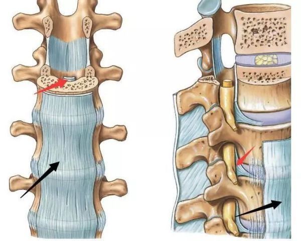 椎骨的椎弓间的连接,主要有什么物质?