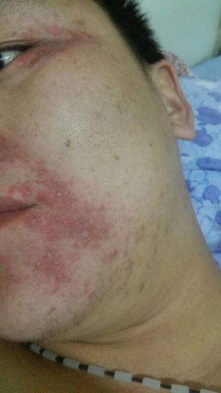 求各位懂医的好心人帮我看看这是什么皮肤病,不疼不痒