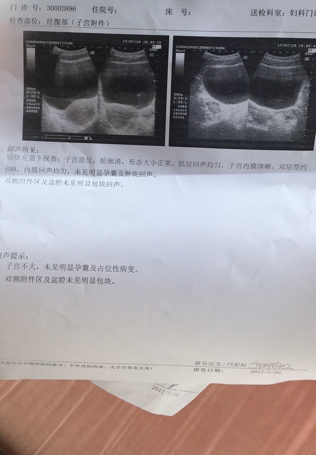 清宫一个礼拜复查,上面显示子宫内膜清晰,双层厚约6mm,这样是不是代表