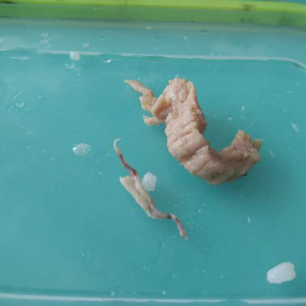 这是猪肉里的寄生虫吗?