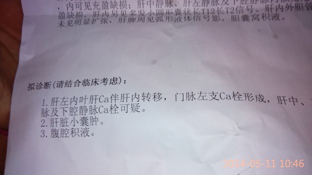 肝癌晚期治疗方法