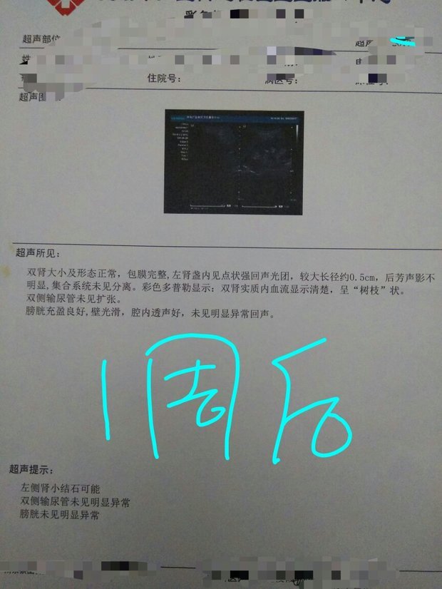 左肾输尿管下部结石,做体外碎石后,1周复查输尿管,膀胱无结石,无肾盂