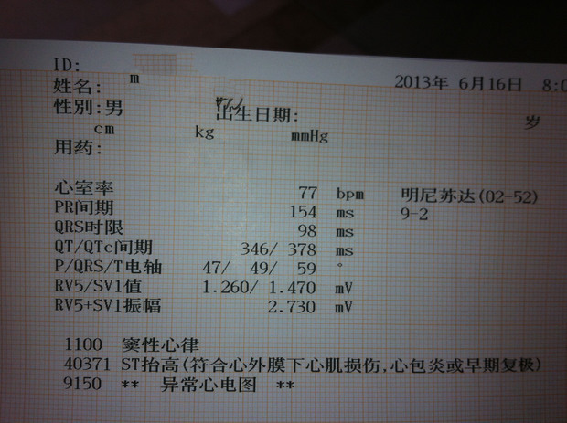 今天去医院检查,发现心电图检查异常,以前平时容易出现心慌,心跳加快