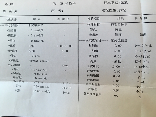 尿常规怎么检查 检查尿常规医保