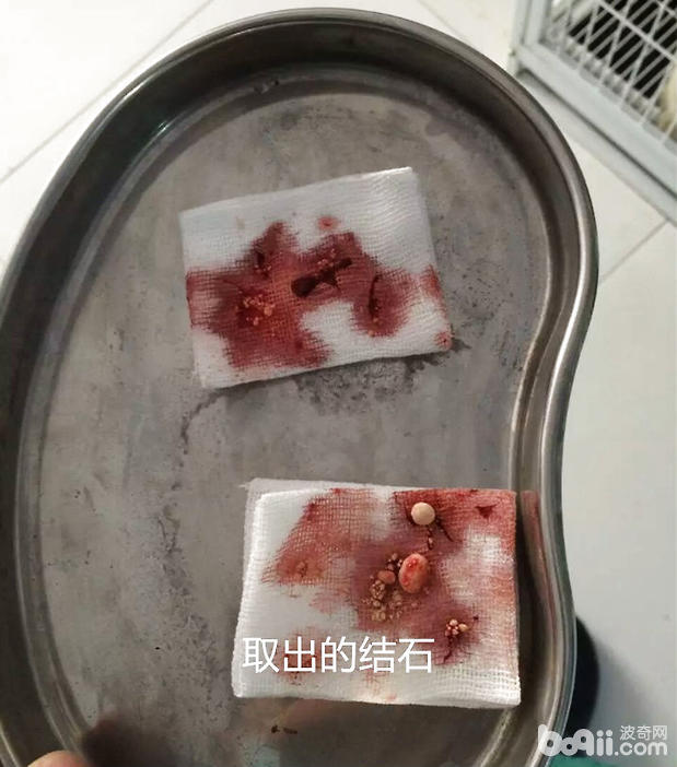 我是膀胱结石要做什么手术才好