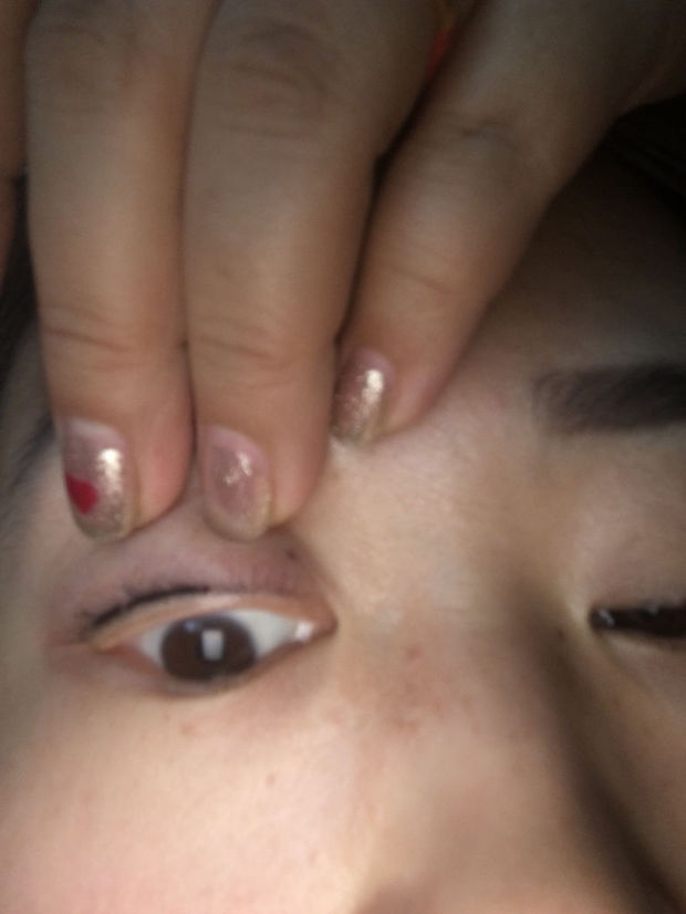 美瞳线掉痂后几乎没有颜色后期真的会反色么?有后期反色的小仙女么?