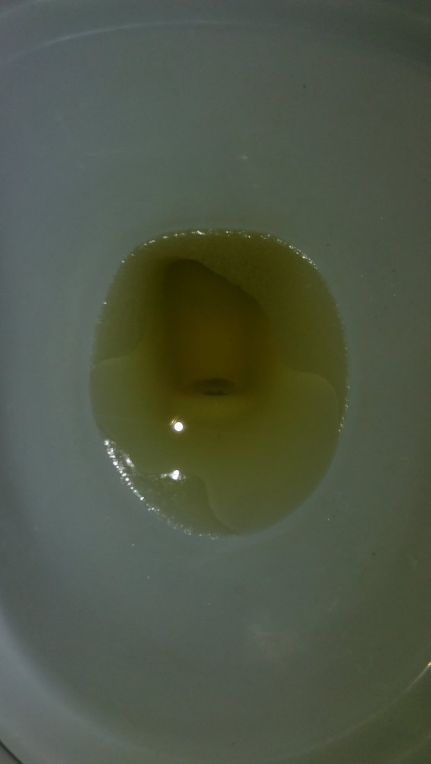 但是我时有时无的尿尿会有一层细小的泡沫,好久都不散