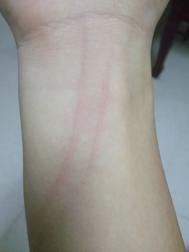 被兔子抓伤了要不要打狂犬疫苗吗