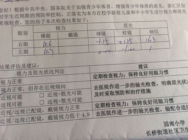 球镜-1.25,柱镜-0.25,什么意思?