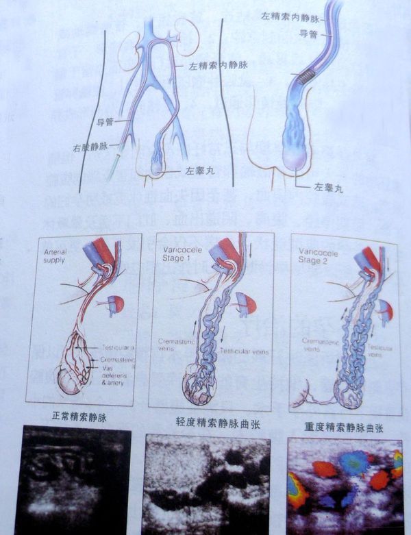 睾丸动脉,蔓状静脉丛,输精管动,静脉,神经,淋巴管和鞘韧带等,自皮下环