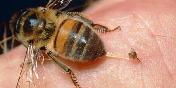 蜜蜂刺刺入皮肤之后会有黑色的小点点        蜜蜂蛰人后一般是连