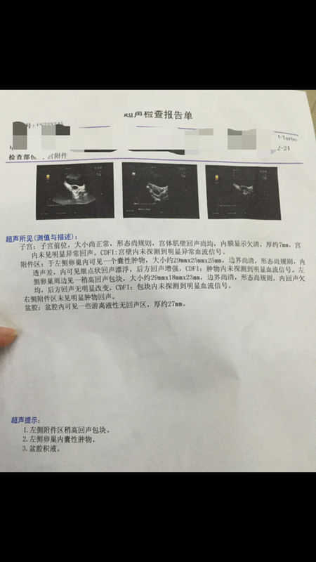 27经期,7天.平时月经准时.11.25经期量少褐色,淋漓