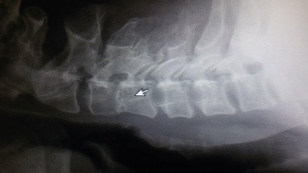 颈椎第3节和第4节间隙模糊,请问是什么原因?会