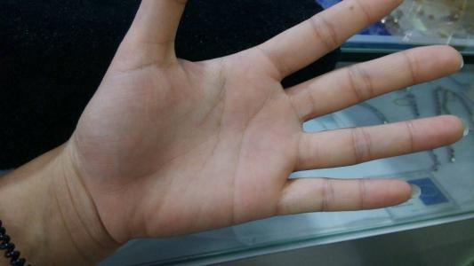 我手掌只有两条线,怎么回事