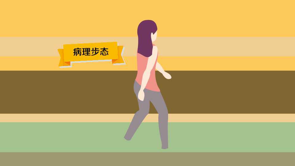  b>病理步态 /b>:步行动作不协调的异常状态