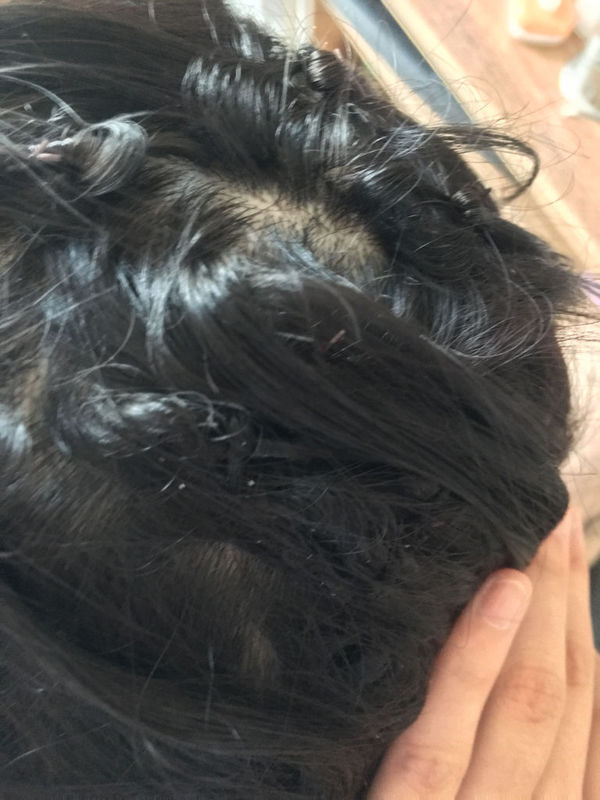 我接头发有两个月了,今天发现头发里头有白色