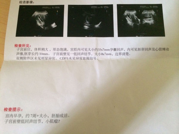 怀孕7周香港验血结果是男孩,而昨天16周照B超