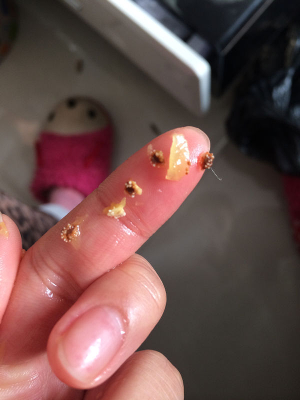 吃菠萝吃出来的,这都是什么阿,是不是虫子阿,很害怕阿,也不动,菠萝