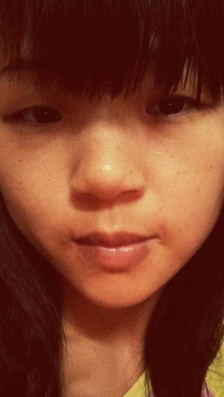 好烦!这几年脸上明显长了好多斑了,我人本身就