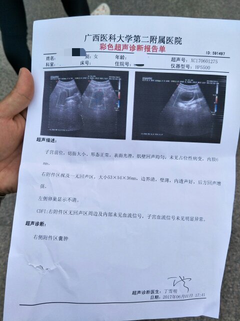 右侧附件区囊肿53×54×36mm严重吗?应该是功能性的?