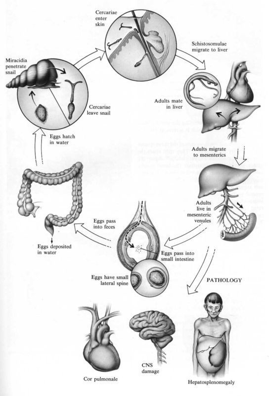 血吸虫发育的不同阶段,尾蚴,童虫,成虫和虫卵均可对宿主引起不同的