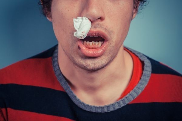 为什么鼻腔会经常干燥还有流鼻血?