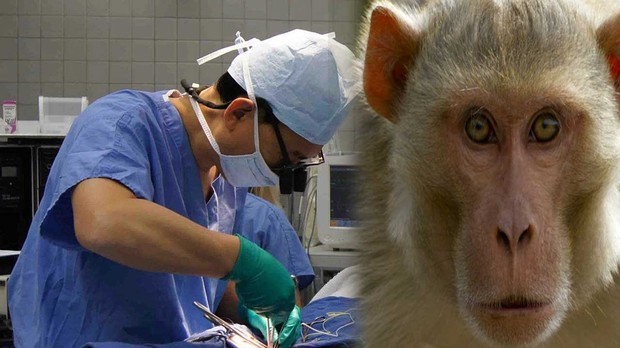 猴子换头手术图片