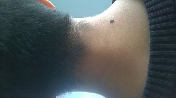 我男,脖子右下角有个大痣,是吉是凶