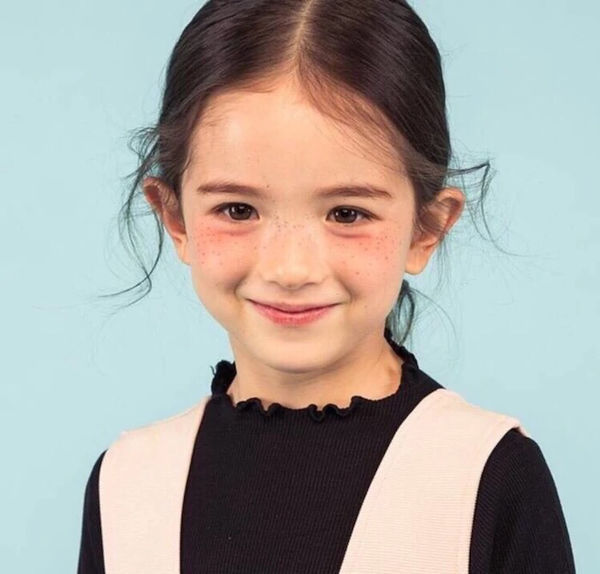 脸上有小雀斑的!