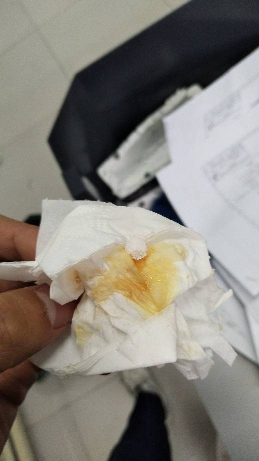 为什么鼻涕是黄色的