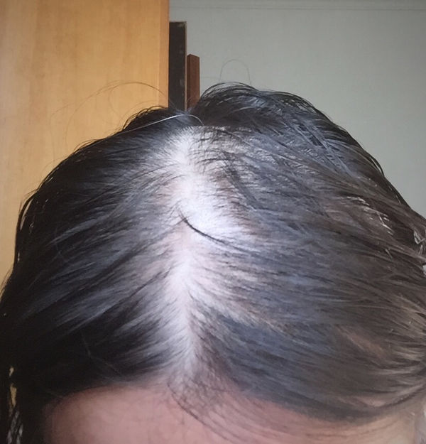 我的头发属于细软发 特别少.