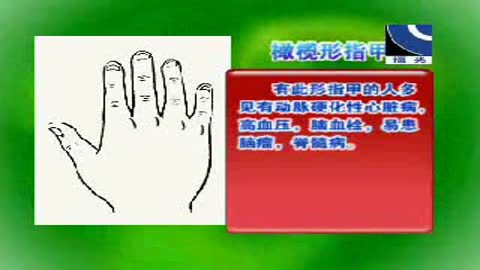 [图]健康课堂-20111118-观手察病知健康