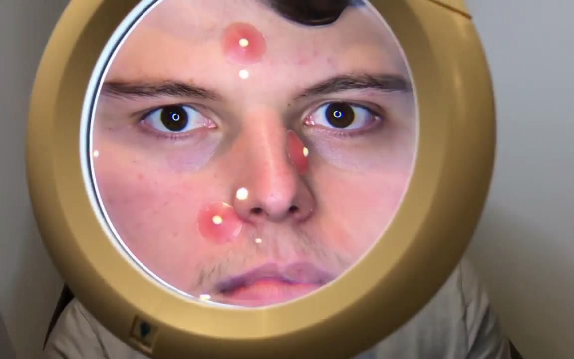 【 b>ben的整人计划 /b>】 b>中文 /b>字幕 - elliot痘痘恶作剧