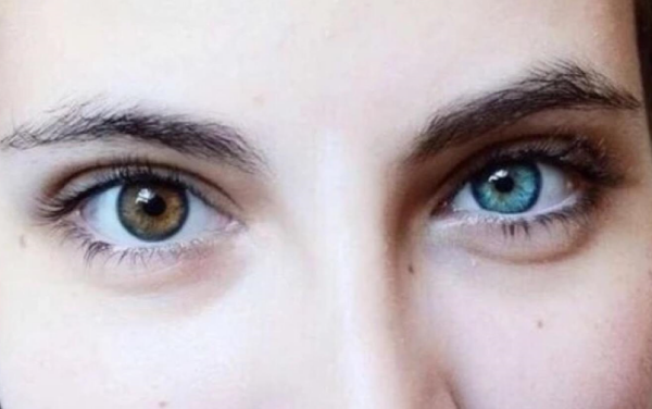 人在死亡前"瞳孔"为什么会放大?